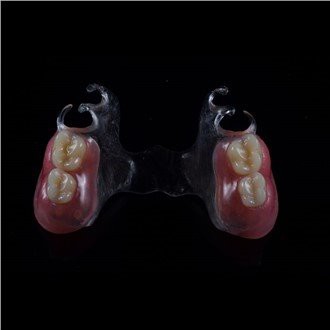 Abnehmbare Acryl-Teilprothese